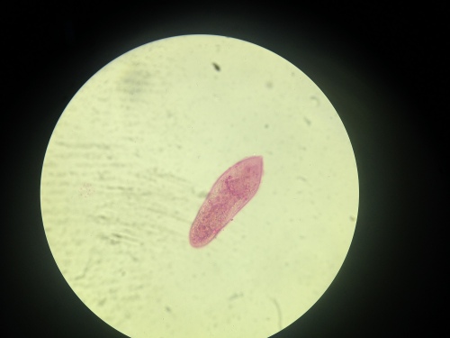 schistosoma mansoni (12)