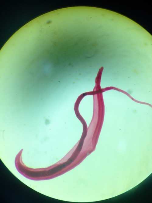 schistosoma mansoni (16)