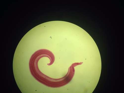 schistosoma mansoni (18)