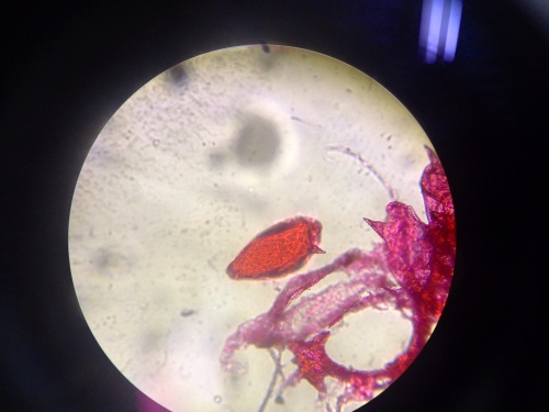 schistosoma mansoni (2)