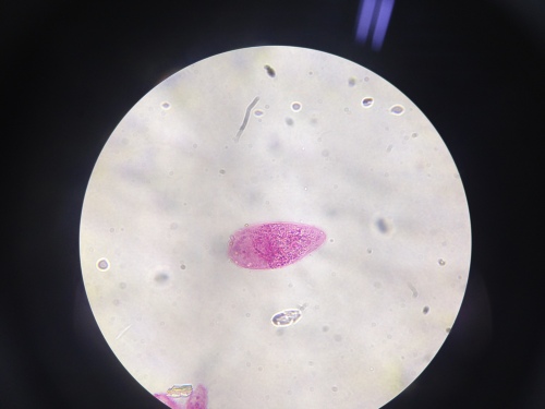 schistosoma mansoni (3)