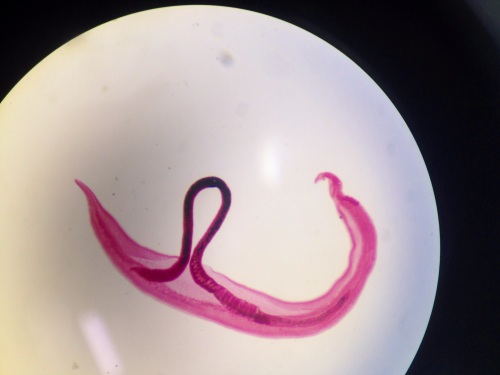 schistosoma mansoni (4)