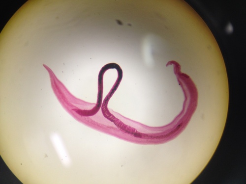 schistosoma mansoni (5)
