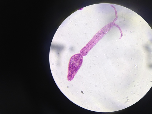 schistosoma mansoni (8)