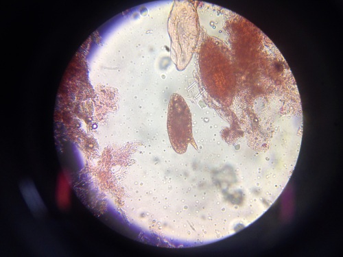 schistosoma mansoni